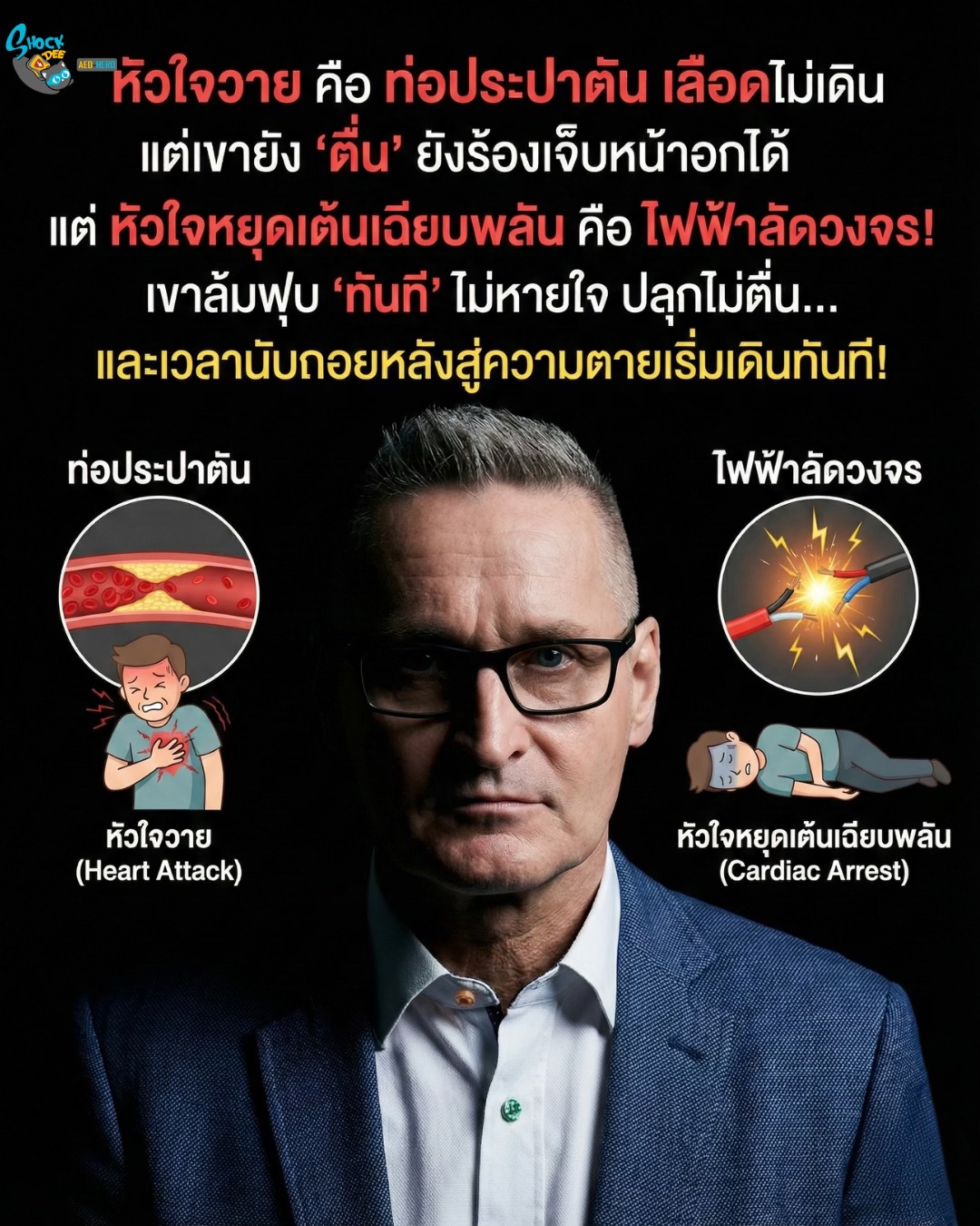 ไขข้อสงสัย: หัวใจวาย (Heart Attack) กับ หัวใจหยุดเต้นเฉียบพลัน (Sudden Cardiac Arrest) ต่างกันอย่างไร?